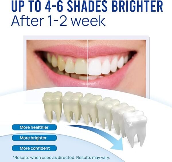 VieBeauti Teeth Whitening Pen (3 Pcs), 30+ Uses, Effective, Painless, No Sensitivity, Travel-Friendly, Easy to Use, Beautiful White Smile, Mint Flavor - Image 3
